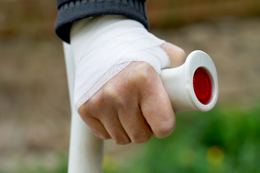 Hand sprain